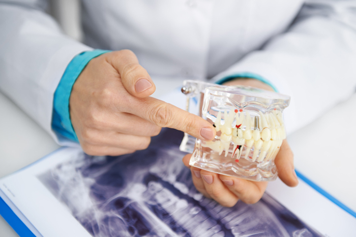 dentist pointing to tooth model